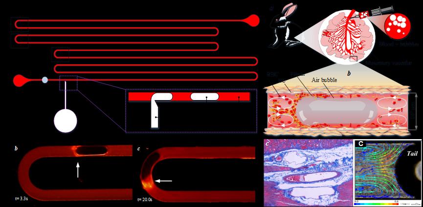 机械工程系李永健课题组揭示血管内气栓发生的关键机制-AG(中国)AG·官方网页版网.png 机械工程系李永健课题组揭示血管内气栓发生的关键机制-AG(中国)AG·官方网页版网.png