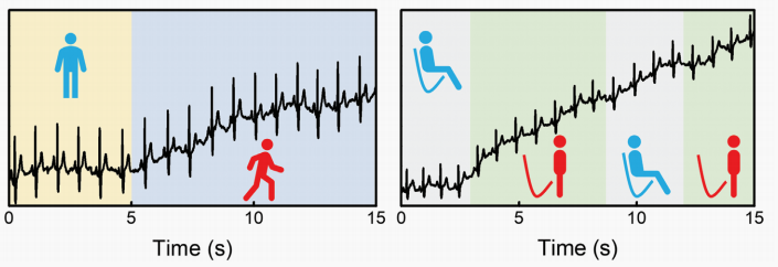 20230303-电子皮肤新闻稿-任天令课题组-图6 动态心电图(选取的II导联数据作为代表)测试波形.png