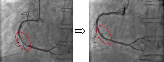 20230110-绿色通道3-医院供稿-医院供稿jpg
